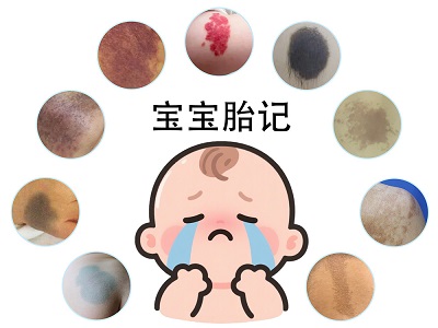 宝宝胎记摸起来粗糙正常吗？需要治疗吗？